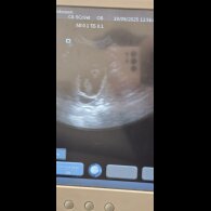 Dachshund (Miniature Smooth Haired)