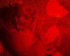 Poodle